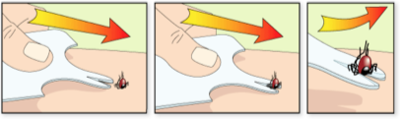 Safecard tekenverwijderaar
