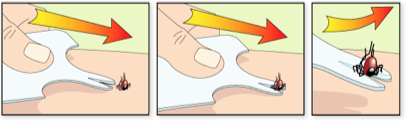 Safecard tekenverwijderaar